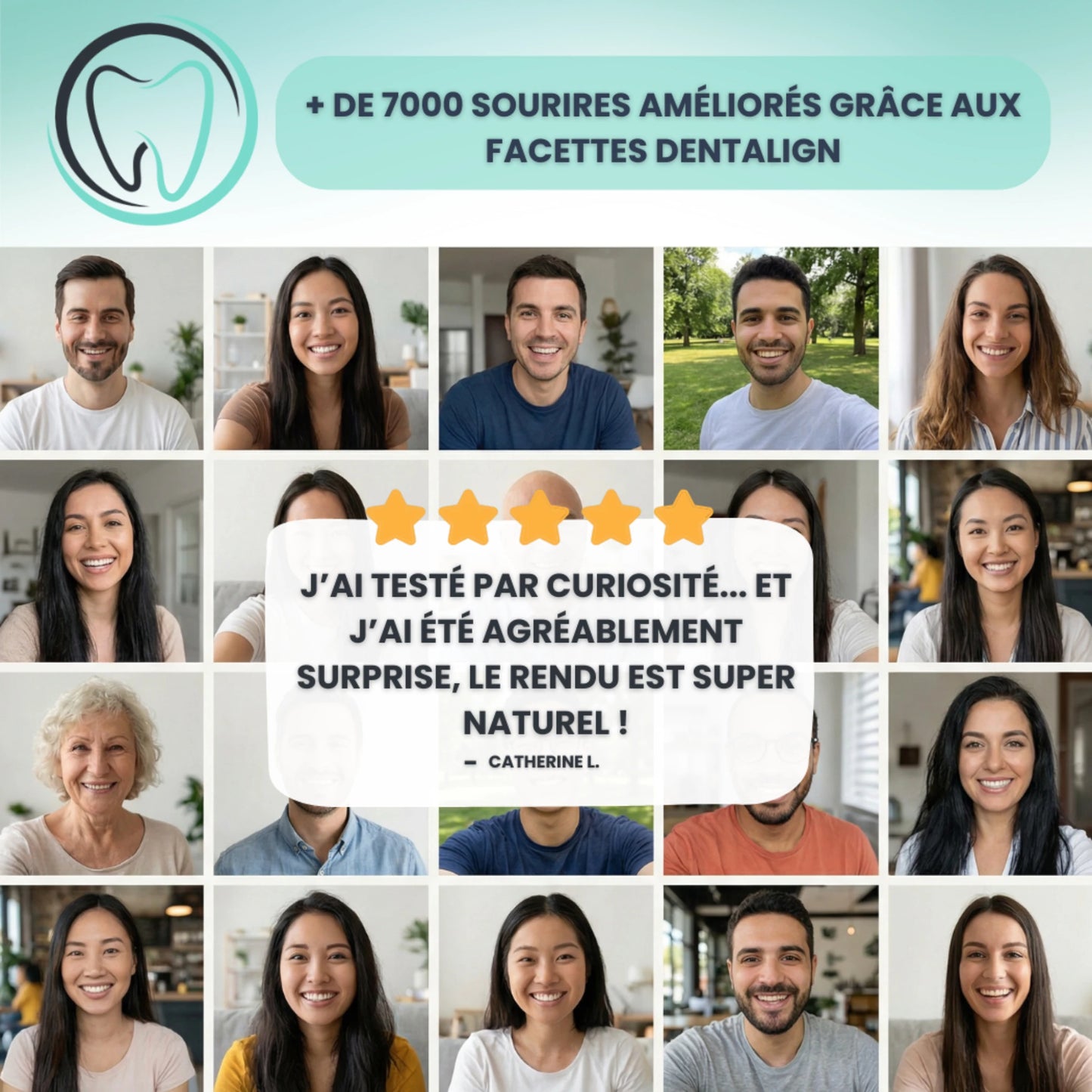 Facettes Amovibles - Dentalign™